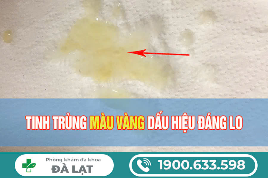 Hình ảnh minh họa